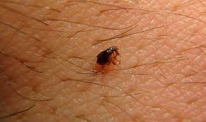 مكافحة البراغيث